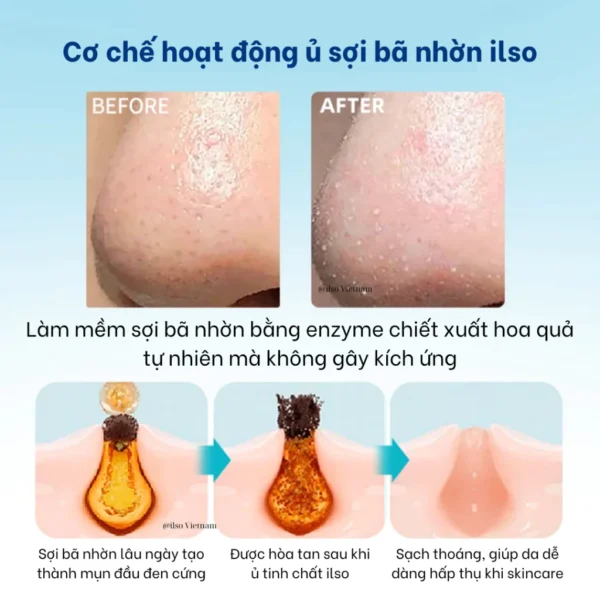 Tinh chất ủ mụn đầu đen, làm mềm sợi bã nhờn ilso Super Melting Sebum Softener 150ml - Hình ảnh 4