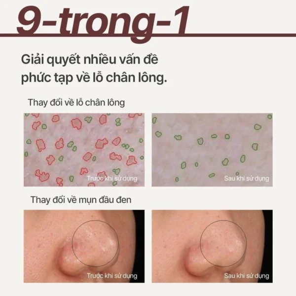Siêu mặt nạ đất sét tro núi lửa giảm nhờn, thu nhỏ lỗ chân lông INNISFREE Super Volcanic Pore Clay Mask 100ml - Hình ảnh 4